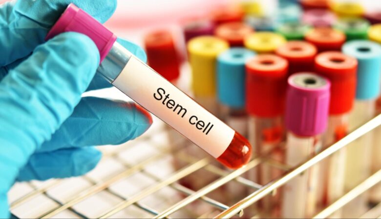 What Are Stem Cells?