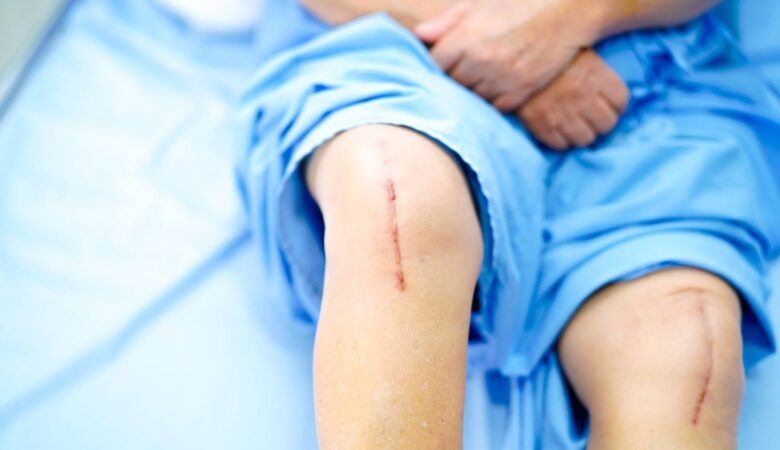 Who Should Consider Investing in Long-Term Care Coverage?