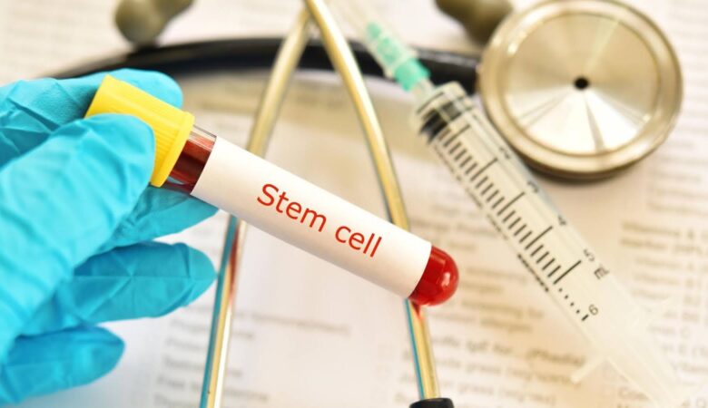 What Are Mesenchymal Stem Cells and How Do They Work?
