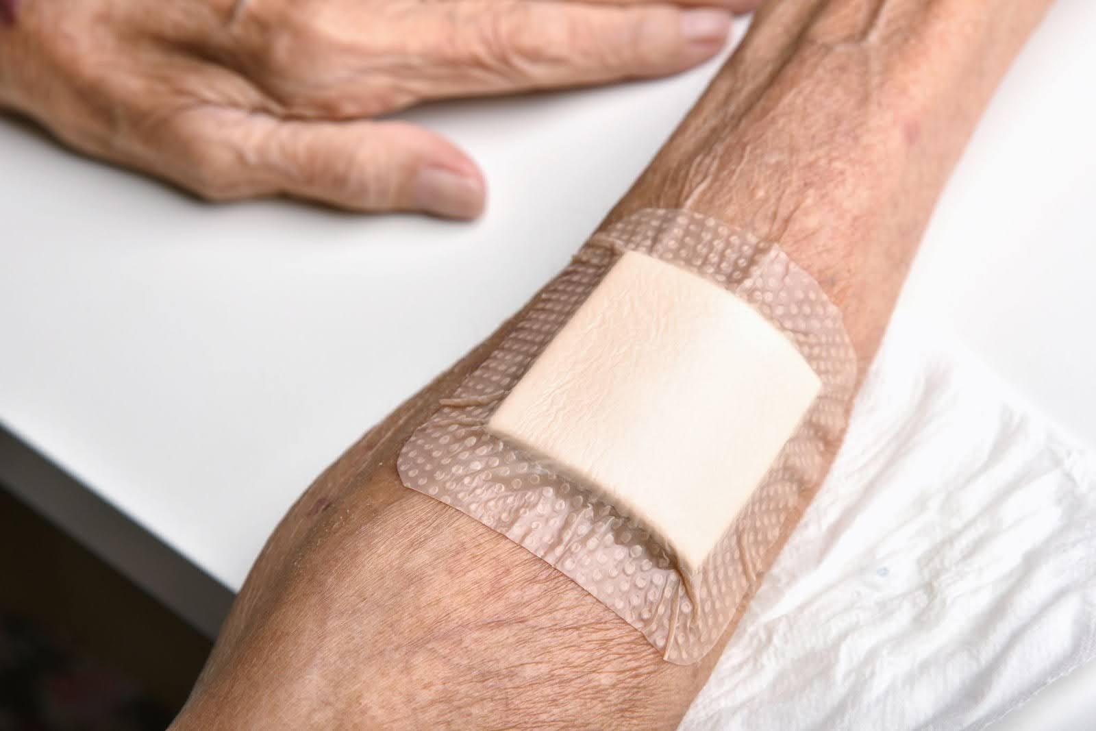 Elderly patient’s inner arm wound treated and covered with an amniotic wound graft.